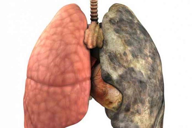 Human lungs